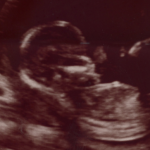 Obituary | Infant Grace Isabel Michelle Marquez of West Bend Grace Isabel Michelle Marquez